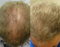 Lustrao Hair Regrowth Oil Lustrao