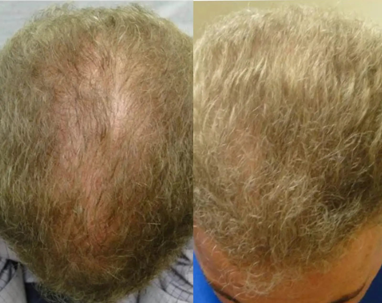 Lustrao Hair Regrowth Oil Lustrao