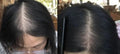 Lustrao Hair Regrowth Oil Lustrao